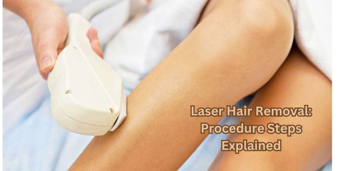 Laser Hair Removal: Procedure Steps Explained