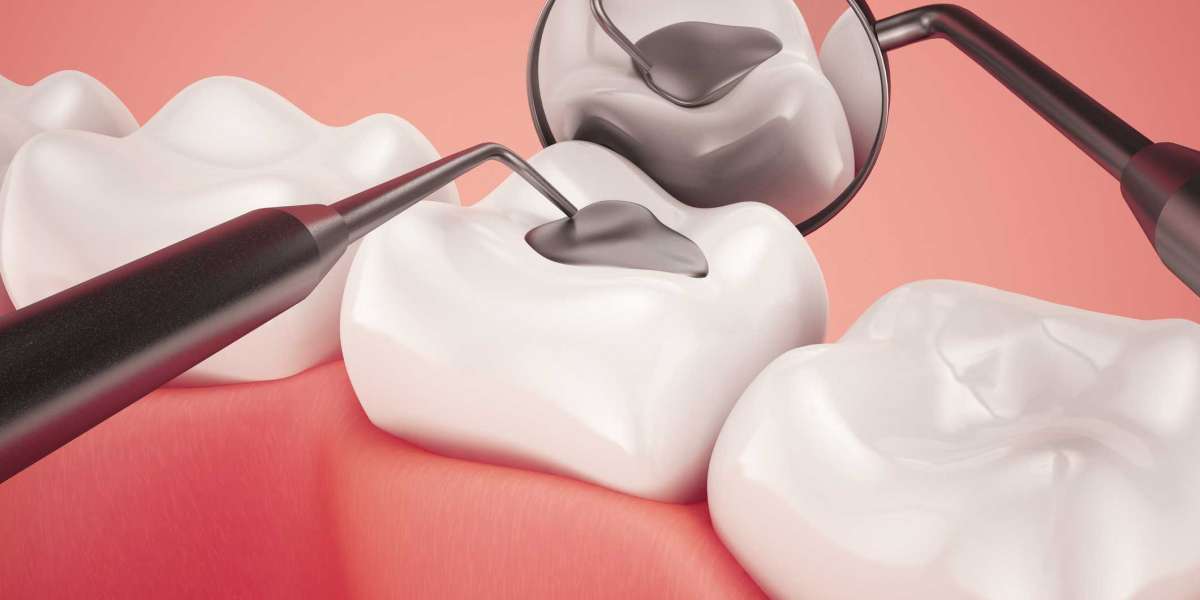 Dental Restorative Materials Market Overview, Scope, Trends and Industry Research Report 2031